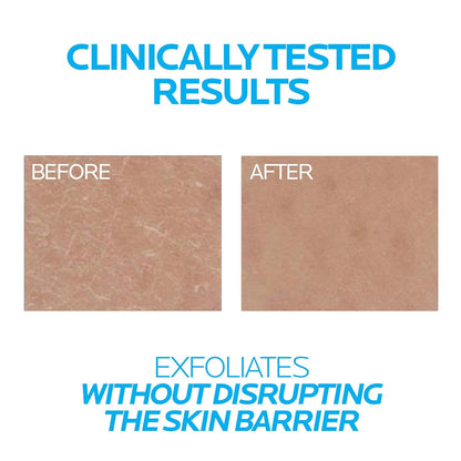 La Roche-Posay Lipikar Urea 10% Roughness Smoothing Lotion, Body Lotion For Dry Skin With 10% Urea + Shea Butter + Allantoin, Rough And Bumpy Skin Lotion, Softens & Smooths Skin With 1 Application