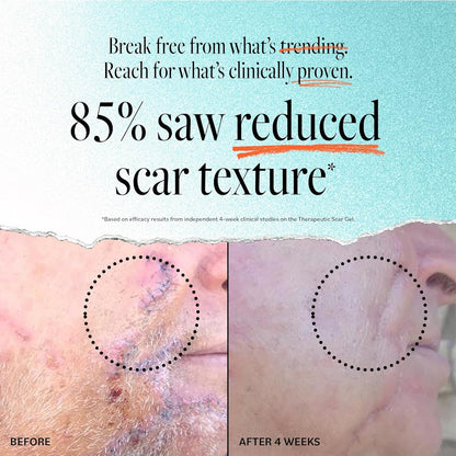 Derma E Scar Gel – Scar Treatment for Face – Hydrating Gel for Acne Scars, Burns & Stretch Marks with Panthenol & Allantoin, 2 oz