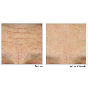 RoC Multi Correxion Crepe Repair Face & Neck Cream