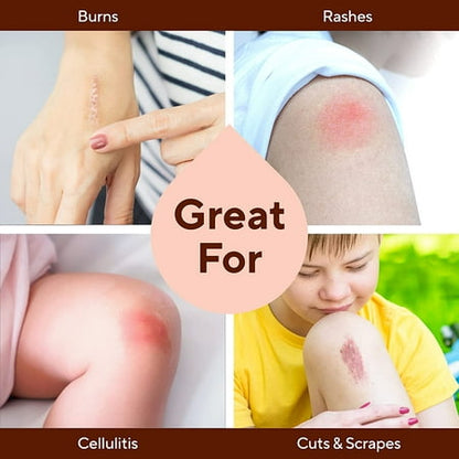 Marie Originals All-Natural Skin Repair and Burn Cream Ointment | First Aid Ointment | Accelerate Wound Healing For General wounds, Chapped Hands, Cold Sores, Eczema, Psoriasis & Burn Ointment