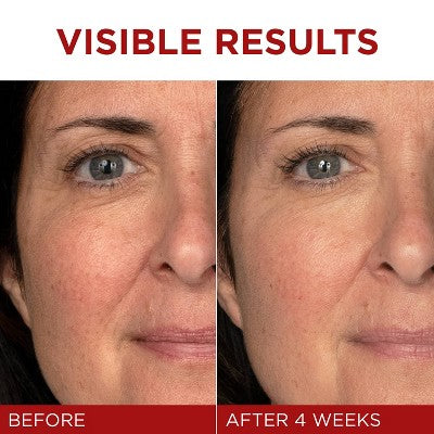 L'Oreal Paris Revitalift Triple Power Fragrance Free Anti-Aging Face Moisturizer - 1.7oz