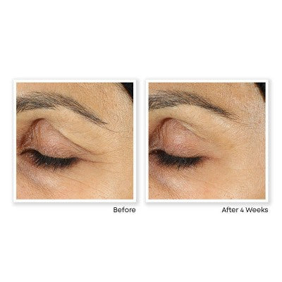 RoC Retinol Correxion Line Smoothing Anti-Aging Wrinkle Eye Cream for Dark Circles & Puffy Eyes - 0.5 fl oz